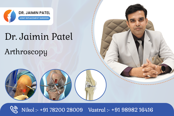 Arthroscopy Surgeon in Ahmedabad