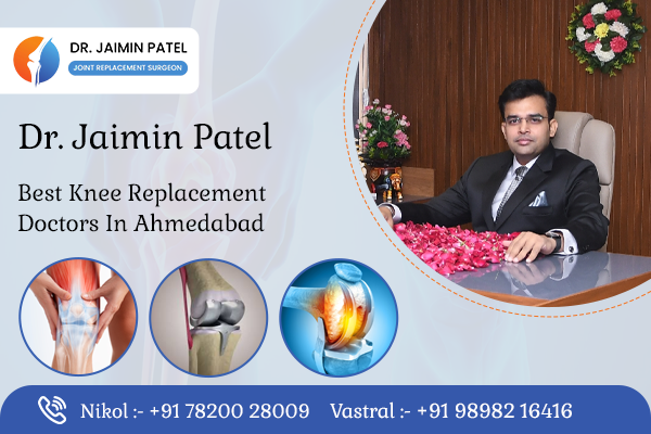 Best Knee Replacement Doctors in Ahmedabad
