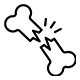 Complex Fracture